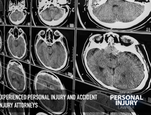 Traumatic Brain Injuries in Personal Injury Cases