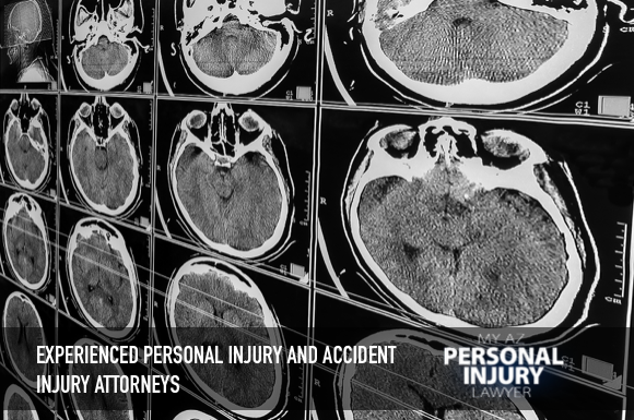 Traumatic brain injury blog