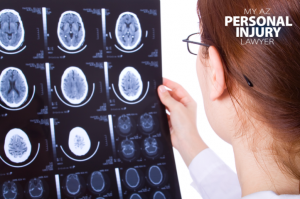 brain injury and personal injury attorney blog