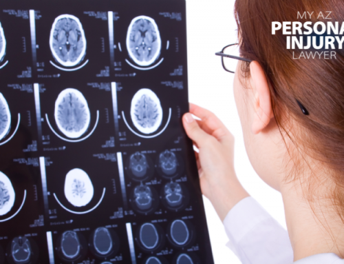 Traumatic Brain Injuries in Personal Injury Cases