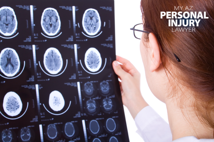 brain injury and personal injury attorney blog